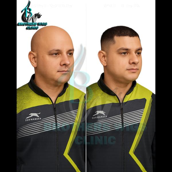 realistic hair solutions delhi