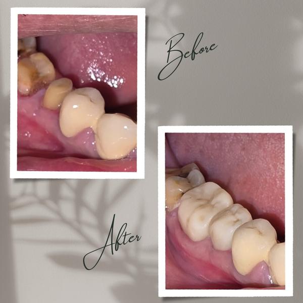 update image