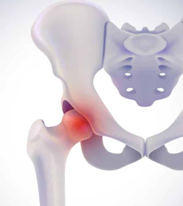 modern hip replacement procedu