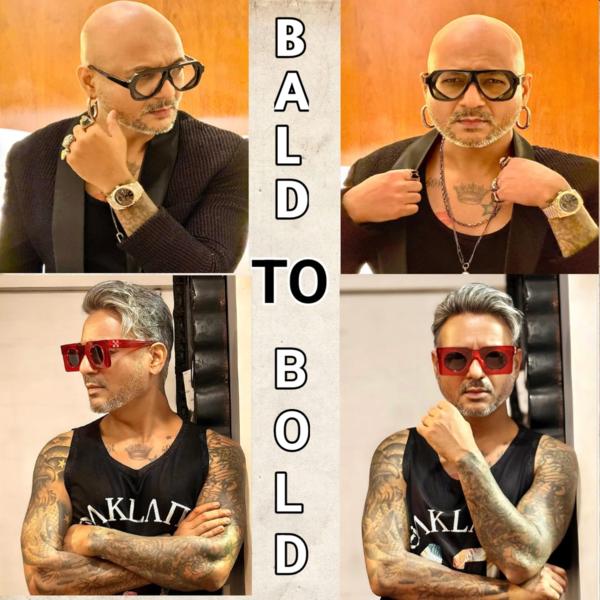 baldness permanent solution in