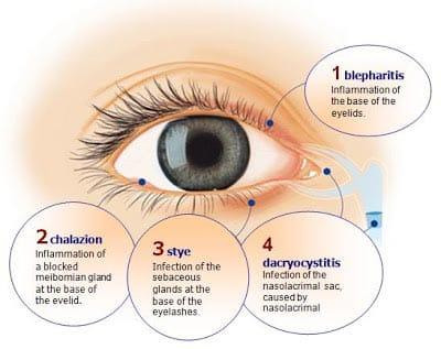 tms eye hospital