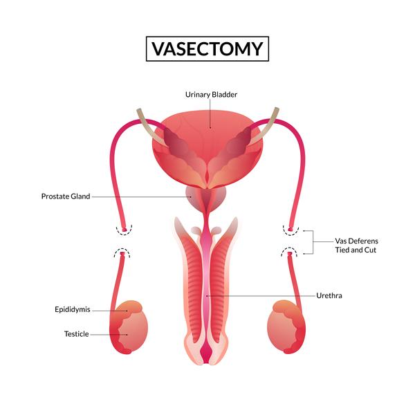 cystoscopy procedure in mumbai