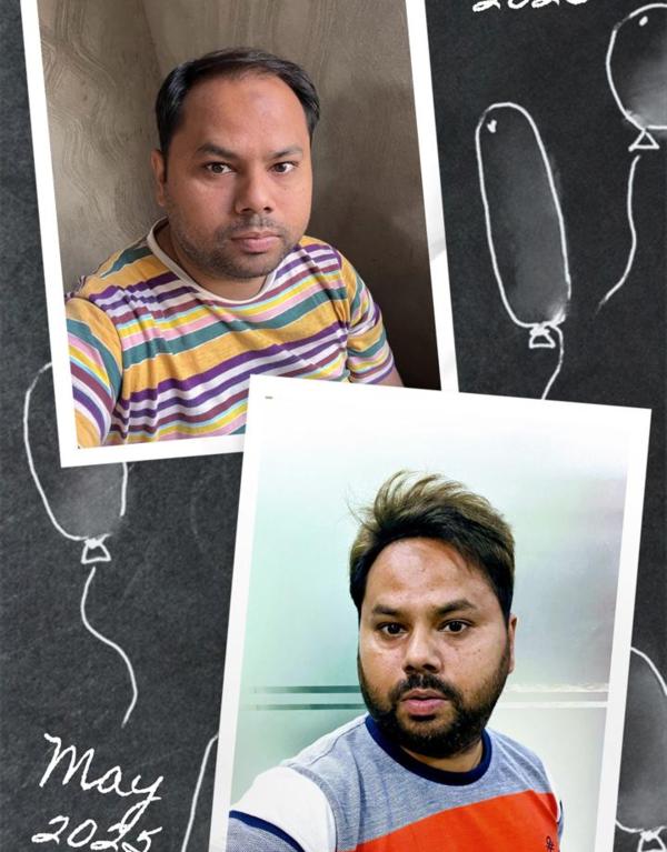 seamless hair patch border rep