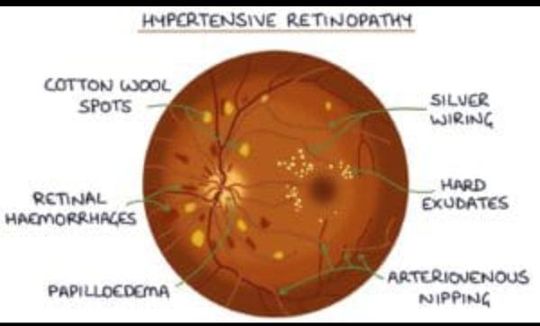 eye clinic in salem