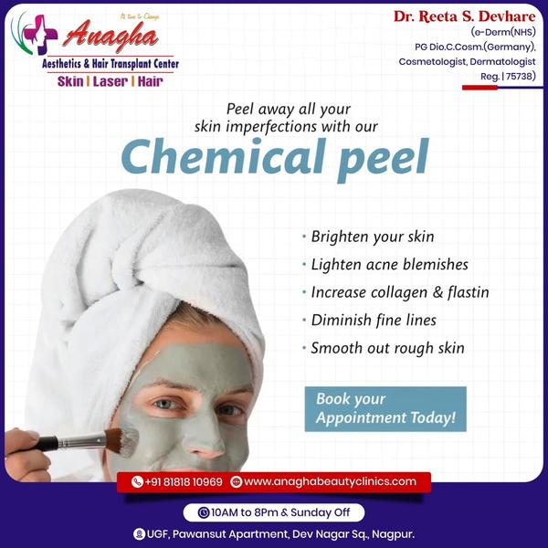 Best Chemical peels treatment In Anagha 