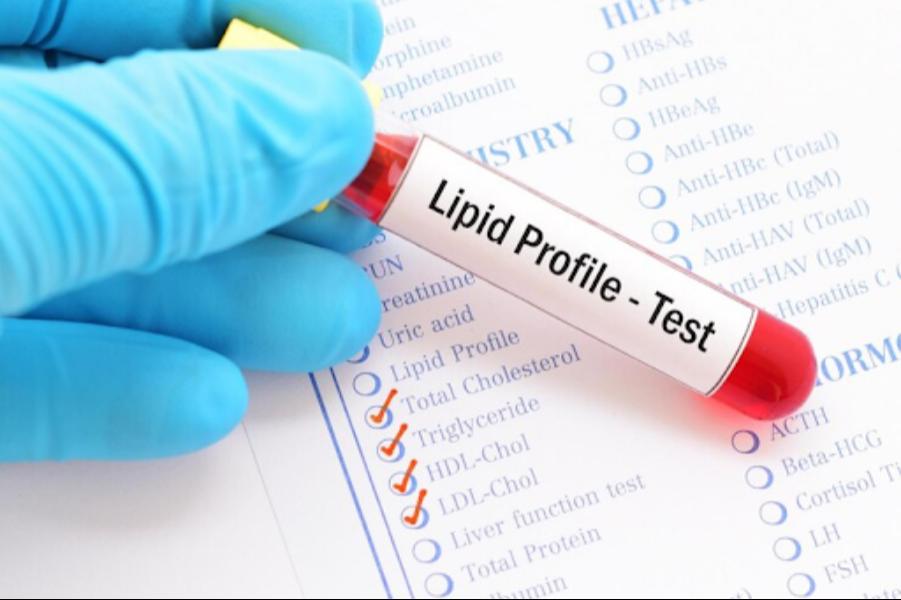 extended lipid profile