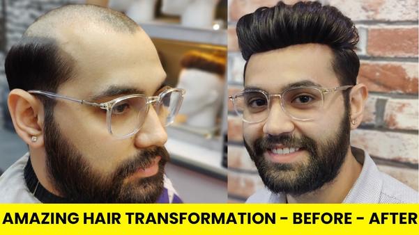 hair weaving clinics in delhi