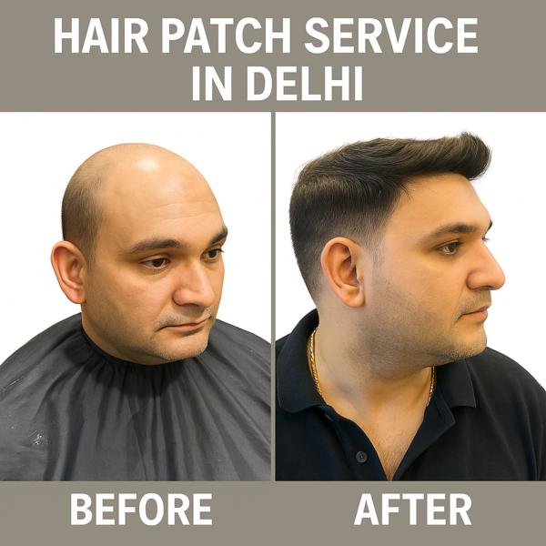 best human hair patch in lajpa