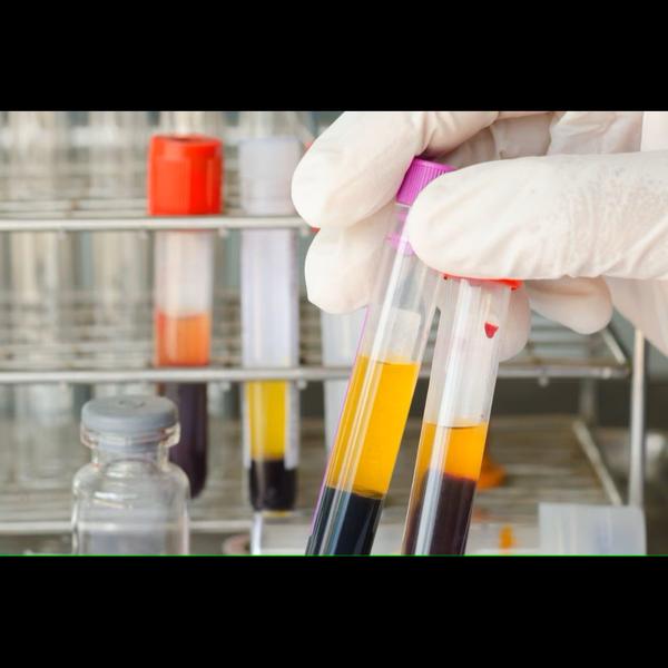 diagnosing cah
