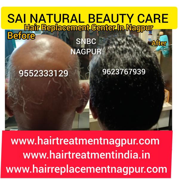 Best Kimo Therapy Hair Wig Center in Nag