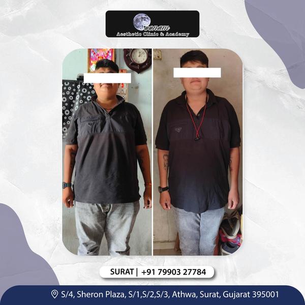 Losing weight isn’t just about