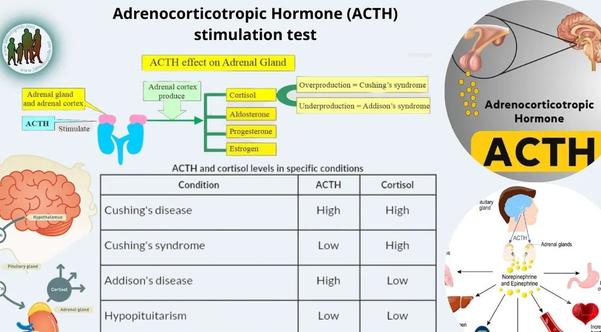 acth stimulation test