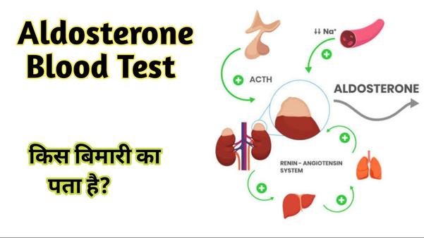 aldosterone level