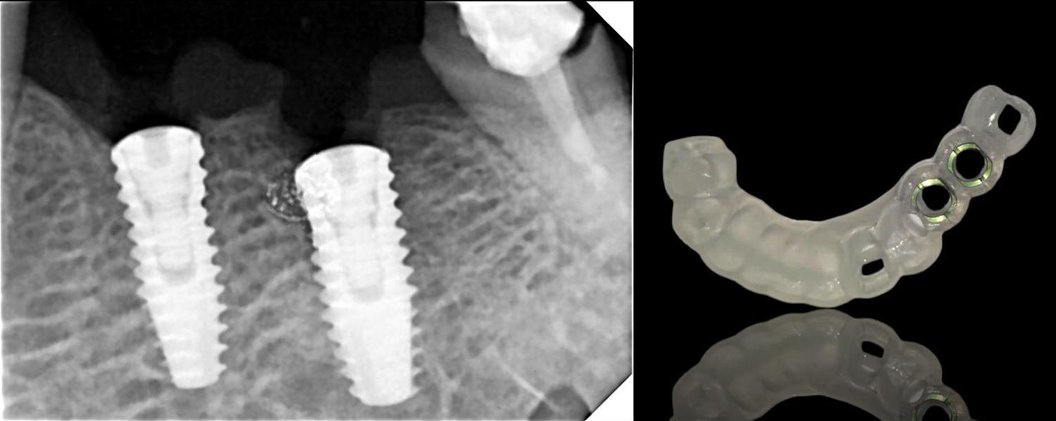 update image