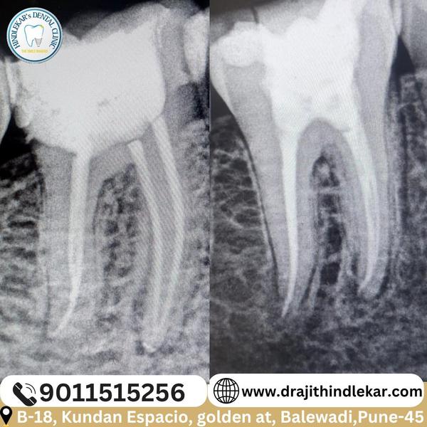 update image