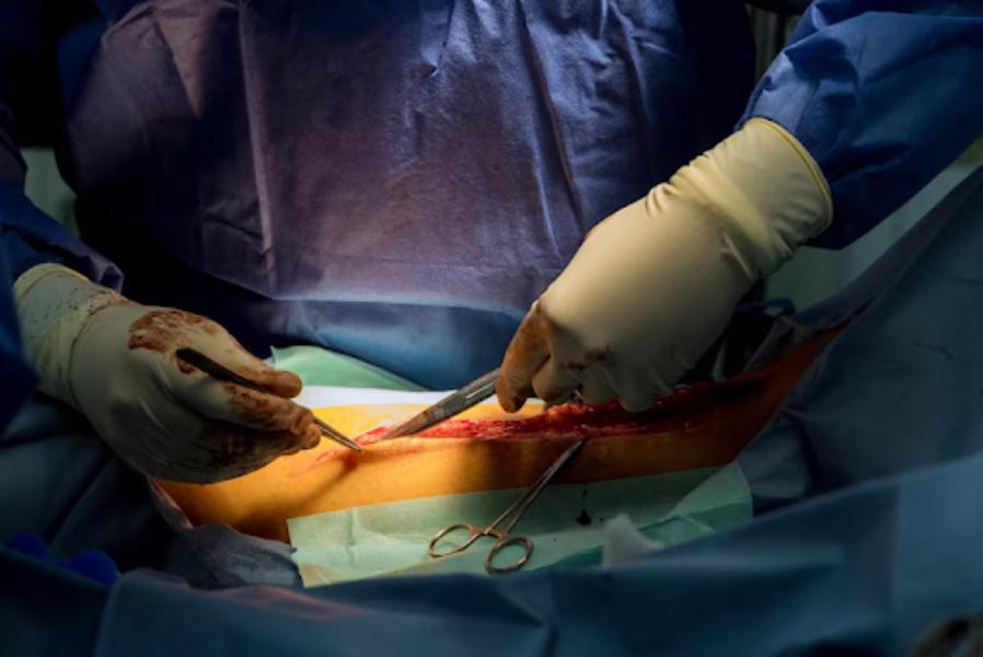 abdominal surgeries