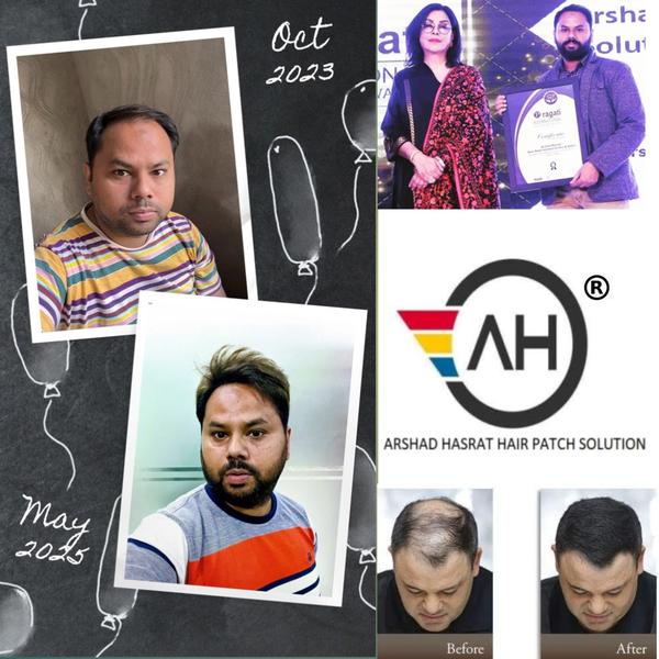 seamless hair patch border rep