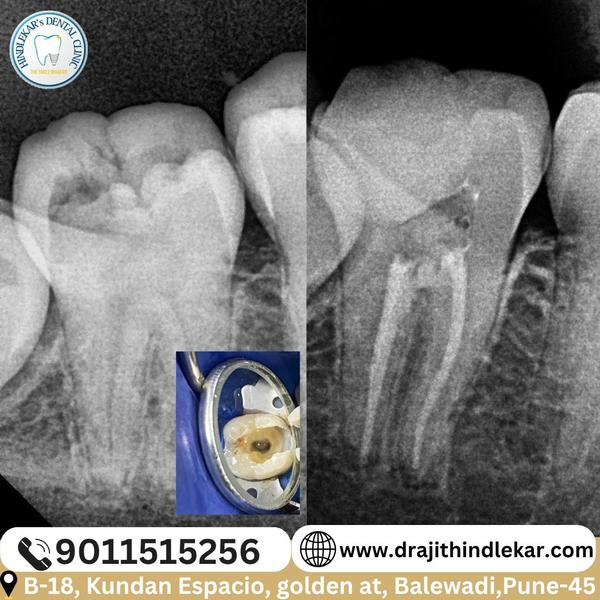 update image