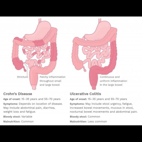best gastroenterologist in jai