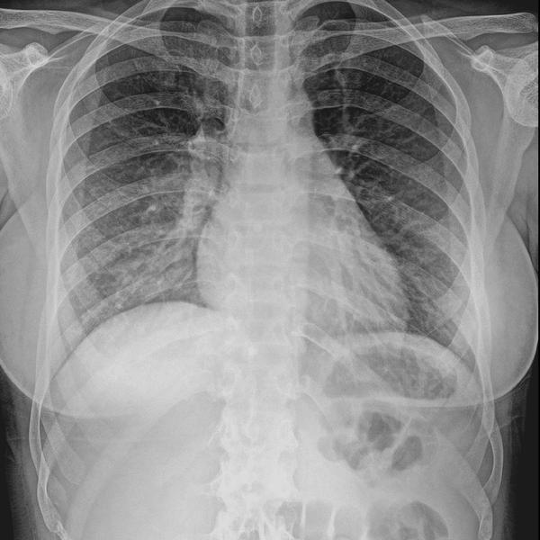 Best x-ray service in pune Kon