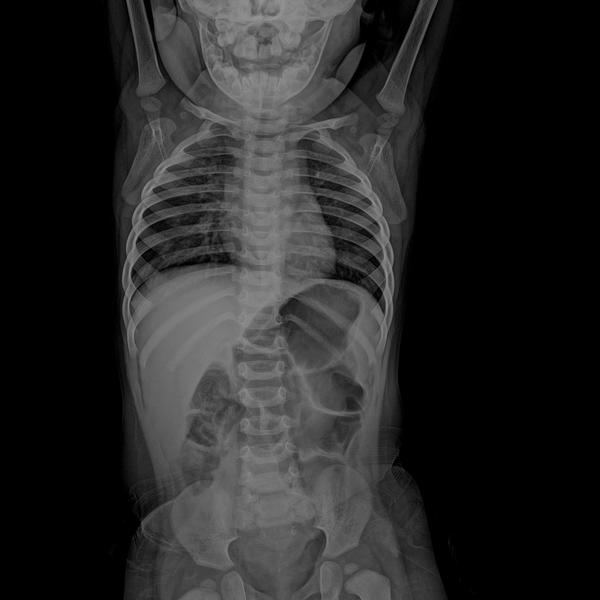 Radicare portable x-ray servic