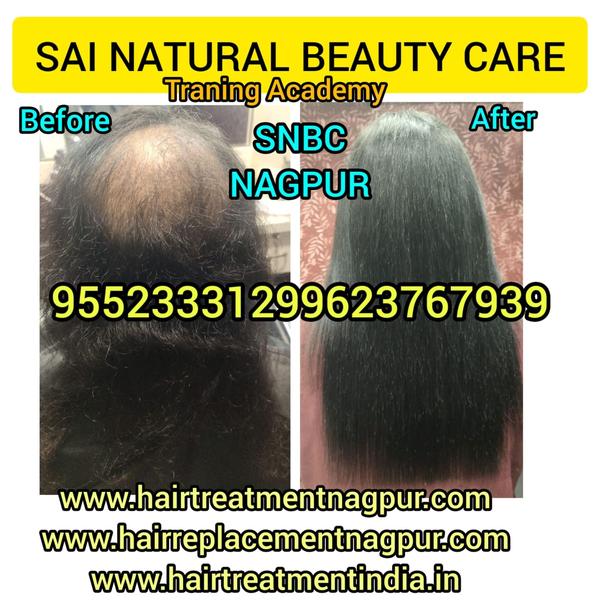 Natural Hair Patches Center in Nagpur fo