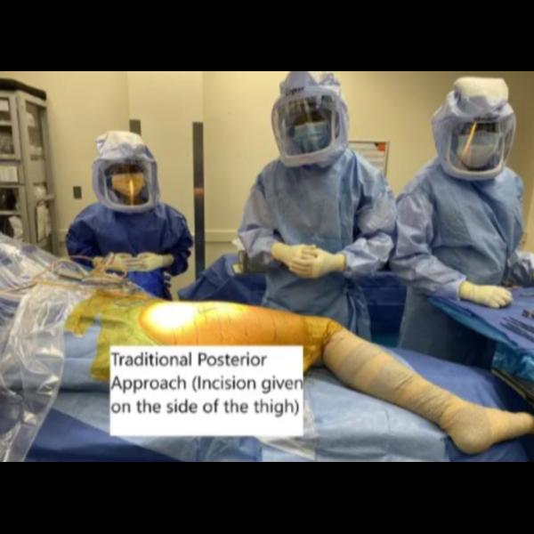modern hip replacement procedu
