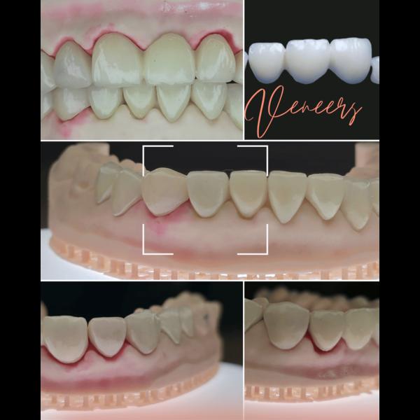 update image