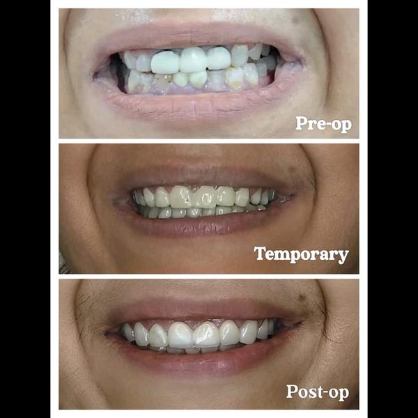 update image