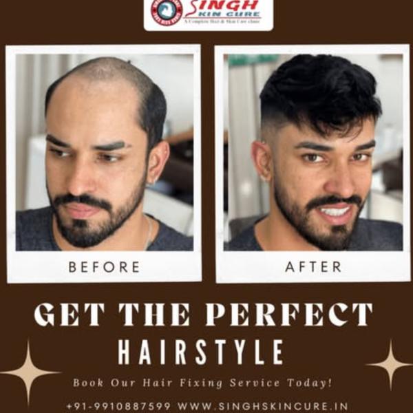 Wig Dealer In Noida Sector 49

We are th