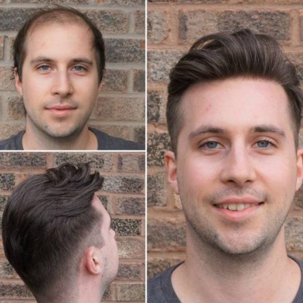 Hair Bonding In Noida Sector 49

Hair Bo