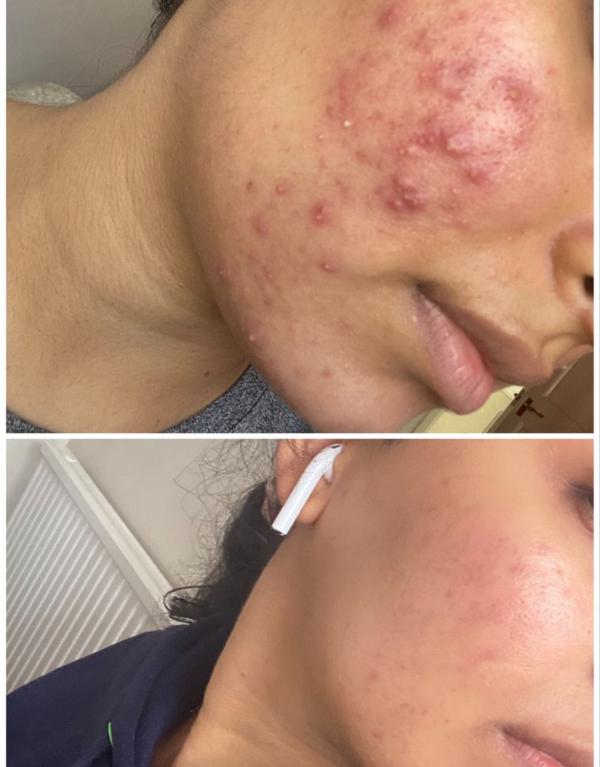 update image