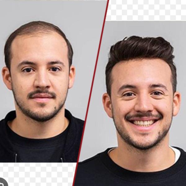 Hair Bonding in Noida Sector 49 

Best H