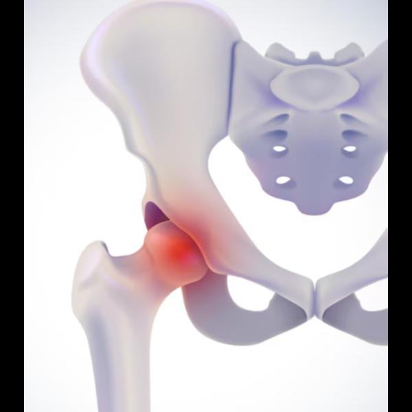 advanced hip replacement techn