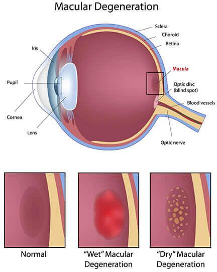 best eye hospital and eye doct