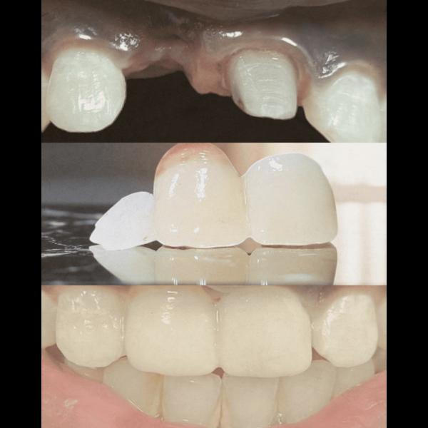 update image