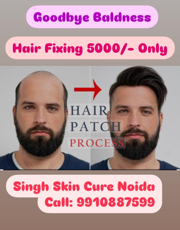 Best Hair Wig Dealer Noida 
Provide Best