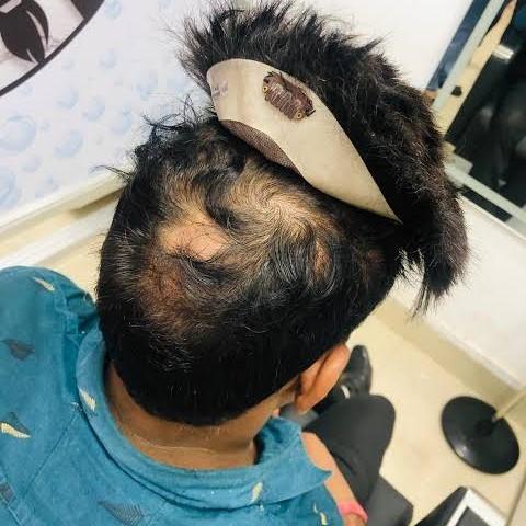advanced techniques