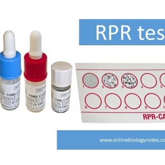 infection control microbiologi