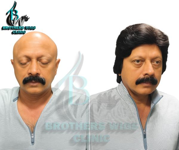 hair fixing in gujranwala town