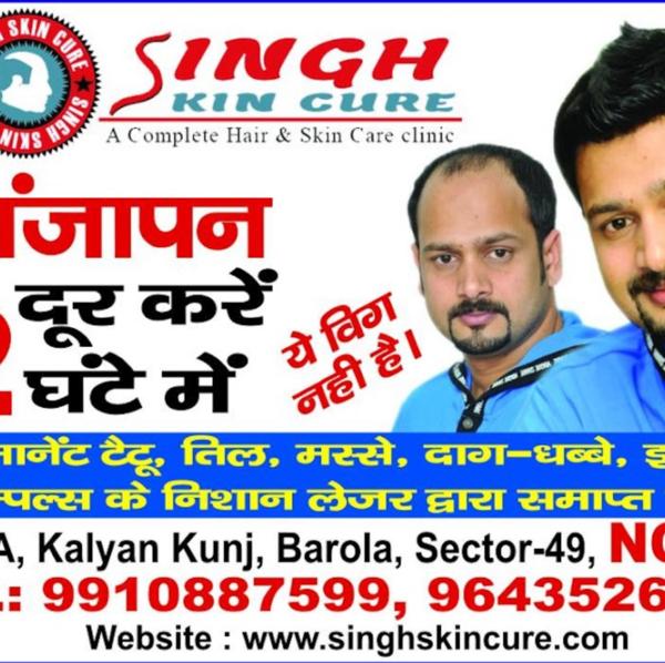 Best hair patch fixing clinic in Noida 
