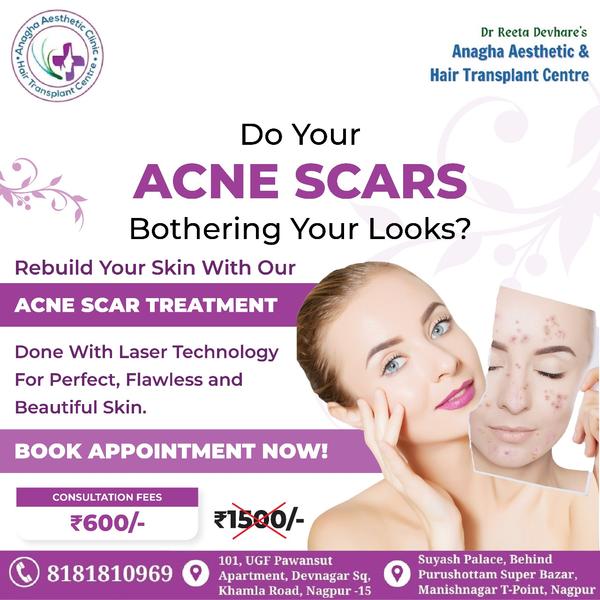 🥼 Acne scar treatment 🥼 🏥 Anagha Aest