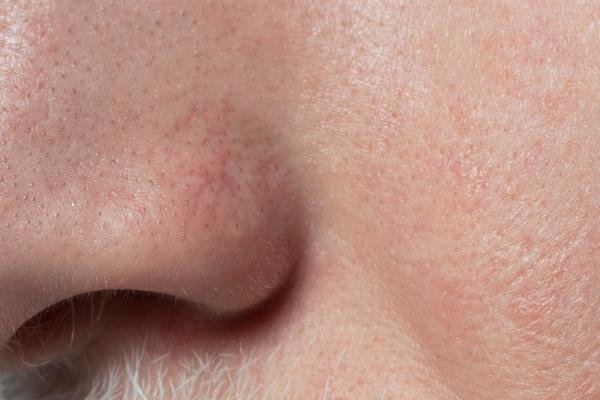 non surgical facelift options