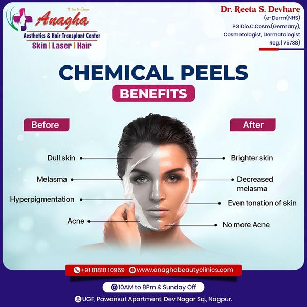 🧖 Chemical peels treatment 🧖 🏥 🧑‍⚕️ 