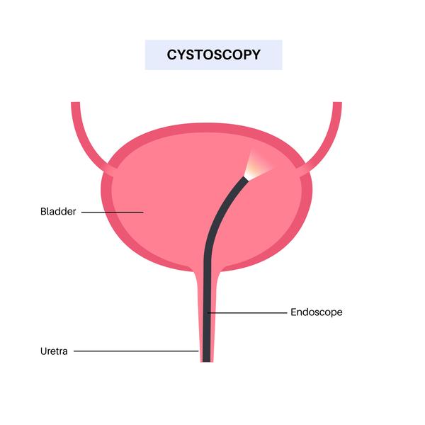 minimally invasive urinary dia