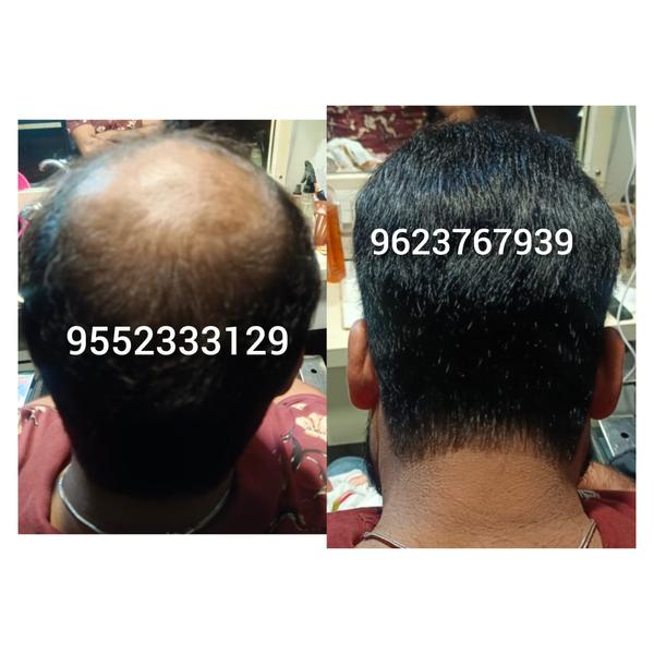 Natural Hair Patches Center in Nagpur fo