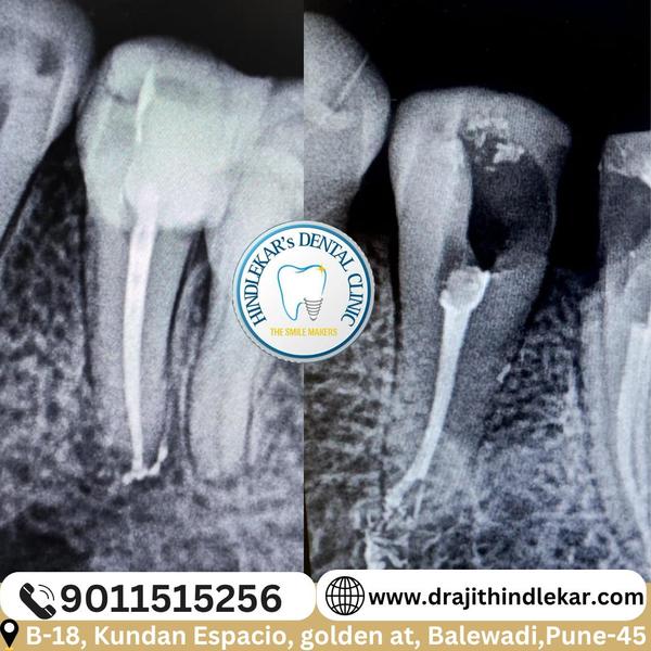 update image