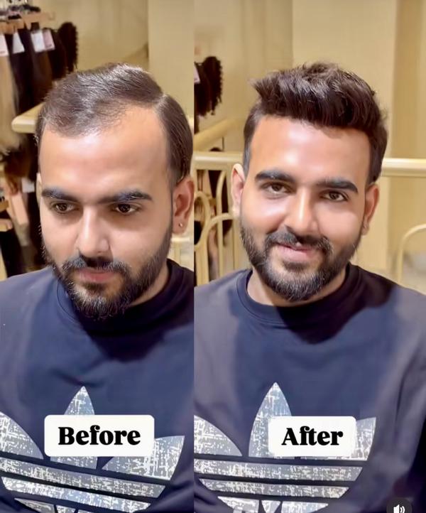 Best hair wig shop near sector 78, Noida