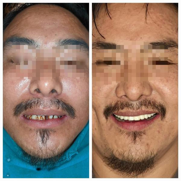 update image