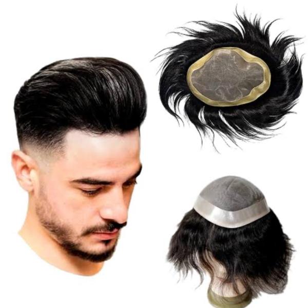 Say Good Bye to Baldness with Singh Skin
